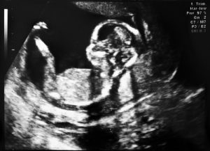 Amami mamma, così avrò il coraggio di abbandonarti