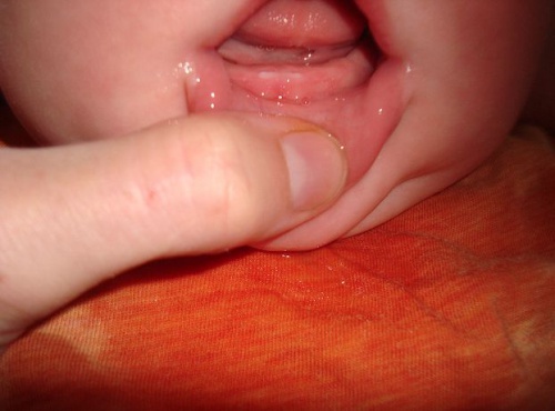 dentizione