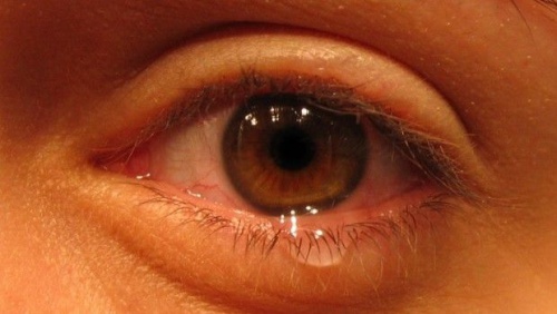 morte di una persona cara