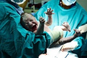 Il parto cesareo può pregiudicare la salute del bambino?