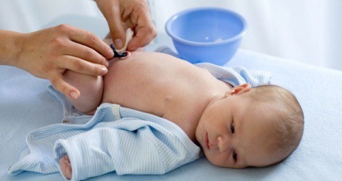 Prendersi cura dell' ombelico del neonato.