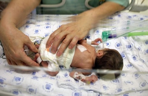 Un neonato riceve le prime cure subito dopo il parto