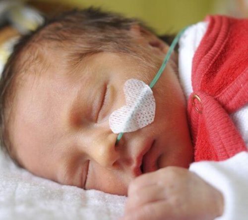 Bambini prematuri: alcuni casi sorprendenti