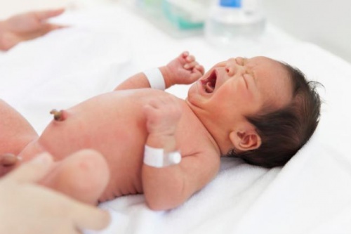 Un neonato piange subito dopo il parto