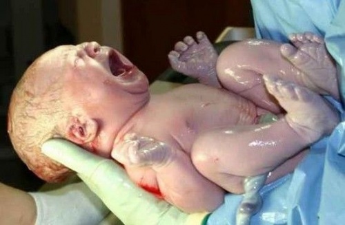 Un neonato piange nelle mani del dottore