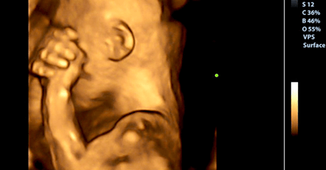 Cosa prova il feto se la mamma piange durante la gravidanza?