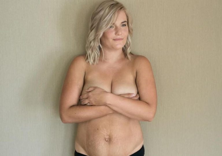 Una madre mostra il proprio corpo dopo il parto
