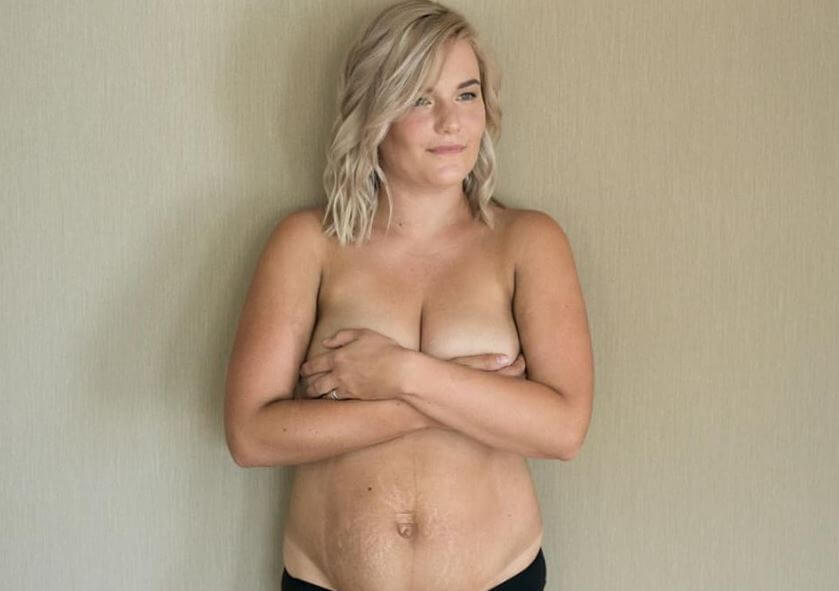 Una madre mostra il proprio corpo dopo il parto