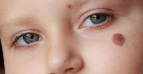 È importante valutare a quale genere appartengono le macchie di un neonato