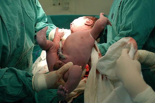 6 attenzioni che riceve il bambino appena nato