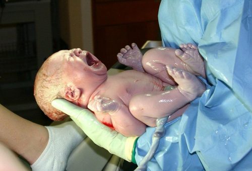 10 tecniche per agevolare il parto 10 tecniche per agevolare il parto