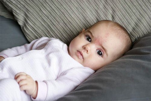 Le macchie dei neonati: quali sono le cause?