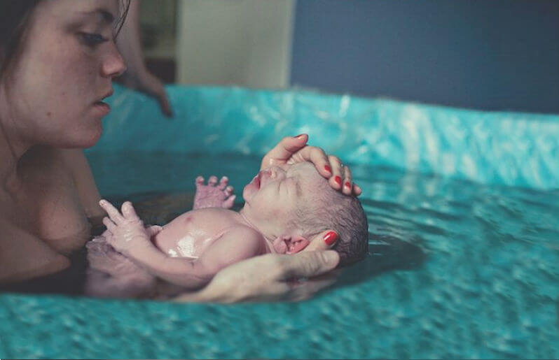 parto in acqua