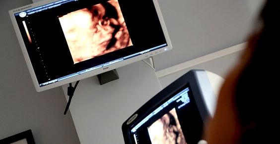 Ecografia per controllare i segni di sofferenza fetale