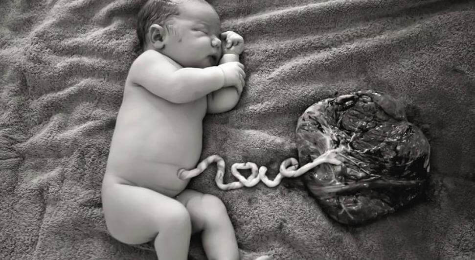 La donazione del sangue del cordone ombelicale avviene dopo la nascita