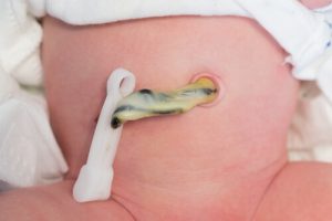 Il cordone ombelicale: che cos'è e qual è la sua funzione