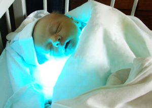 Ittero infantile: cos'è e come si manifesta