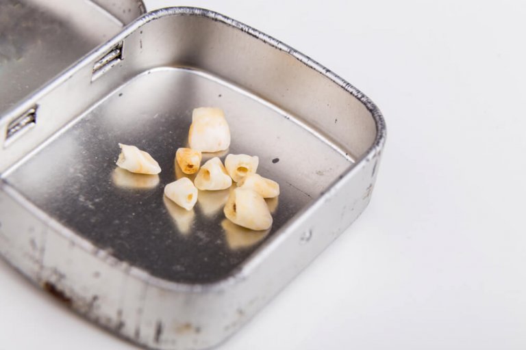 Scatolina con i denti da latte