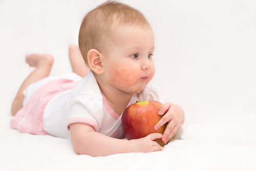 Bambina con herpes neonatale