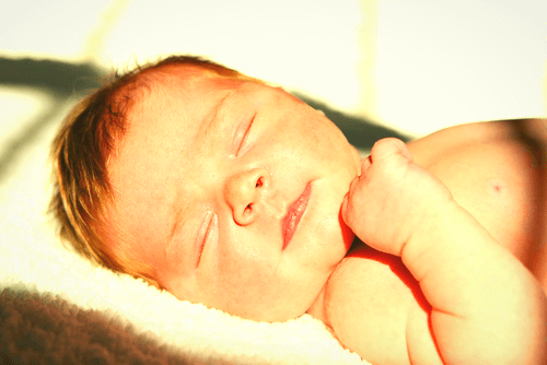 Neonato con ittero neonatale