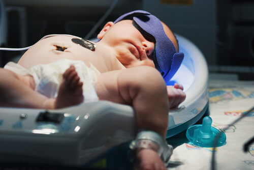 Ittero neonatale: cause, sintomi e complicazioni
