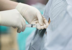 Anestesia epidurale mobile e parto