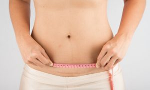 Come prendersi cura della cicatrice del cesareo dopo il parto