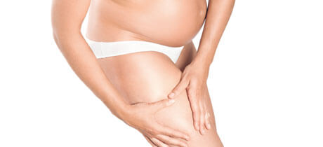 Come prevenire le smagliature durante la gravidanza