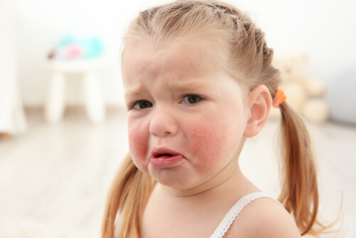 allergie alimentari più comuni nei bambini