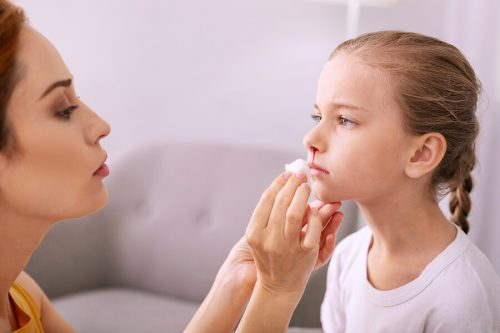 Emorragie nasali nei bambini