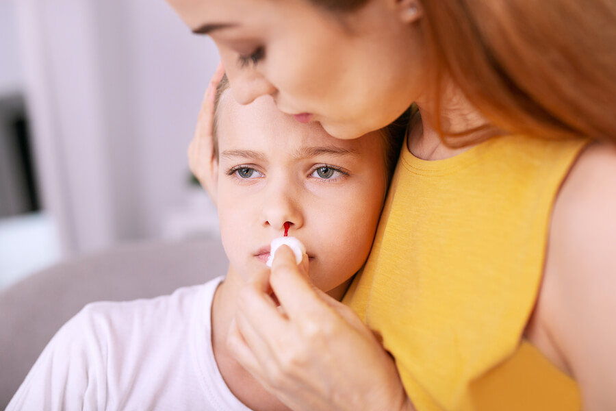 Quando si verificano emorragie nasali, i bambini devono mantenere la testa eretta, oppure lievemente inclinata in avanti