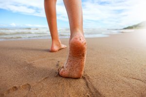 Gambe arcuate: come correggerle nei bambini