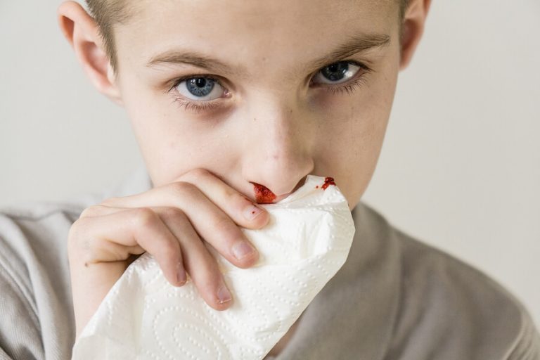 Perché a mio figlio esce sangue dal naso?