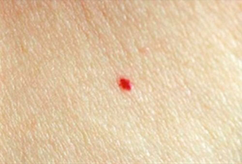 Neo rosso