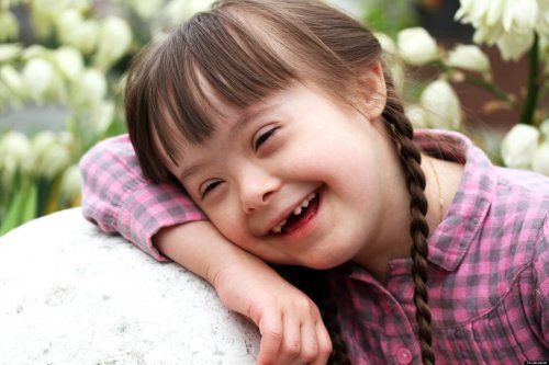 La sindrom di Down è detta anche trisomia 21 per la presenza di un cromosoma in più nel corredo genetico del bambino