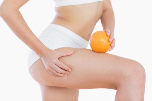 S.O.S. Mamma con cellulite: cosa fare per eliminarla?