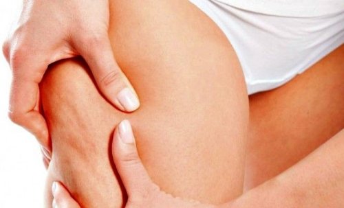 Mamma con cellulite