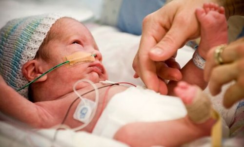 Neonato diversità funzionale