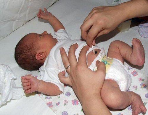 pulizia dell'ombelico bebè