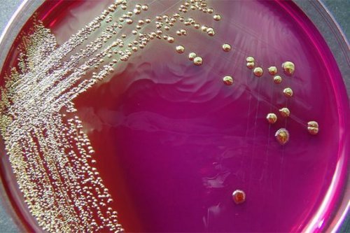 Lo studio per migliorare la diagnosi di mastite ha lo scopo di individuare a quale ceppo appartiene il batterio responsabile dell'infezione