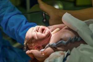 La donazione del cordone ombelicale, come si fa?