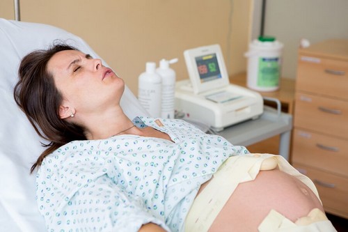 Donna con dolori a causa delle emorroidi durante il parto