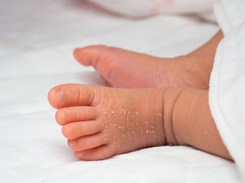 Come prendersi cura della pelle del neonato