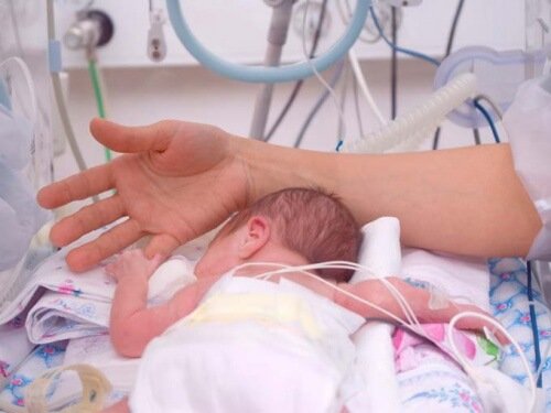 per la maggior parte dei bambini nati prematuri è necessario un periodo di ospedalizzazione