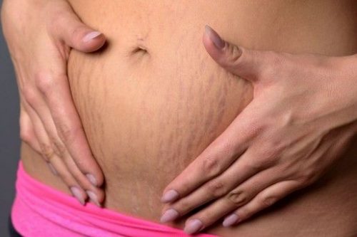 È possibile una gravidanza che non lascia segni?