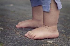 Acondroplasia nei bambini: tutto ciò che bisogna sapere