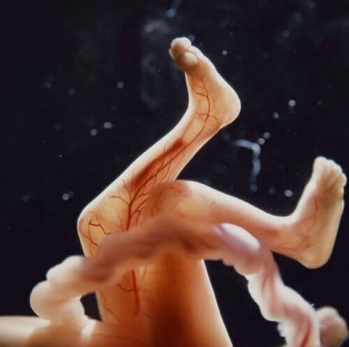 Gambe di feto