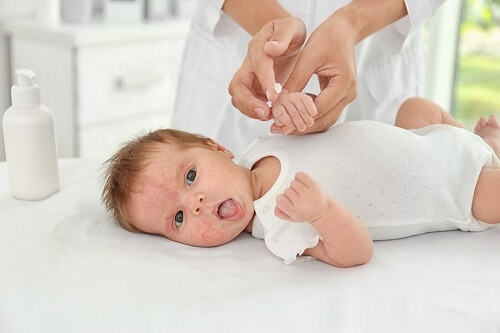 Bimba con dermatite atopica nei bambini curata dalla mamma