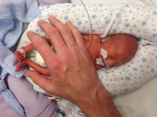 Carezza sul neonato più prematuro