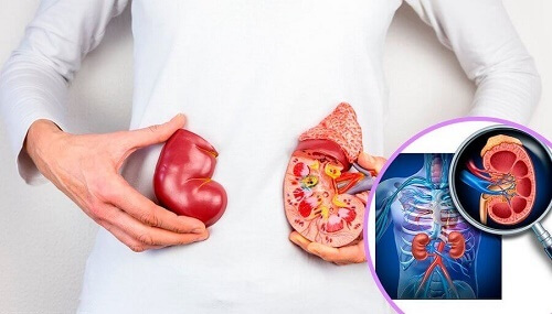 Medico spiega il tumore ai reni nell'infanzia